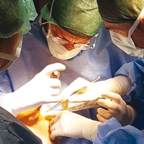 chirurgia-rigenerativa Rigenerare prima di sostituire, l’innovazione del medico gualdese Fiore