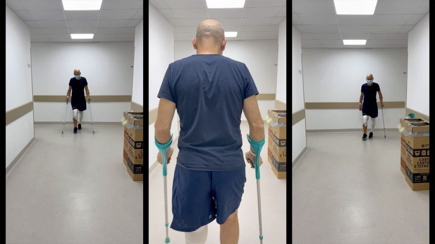ROSA Knee: ottimi risultati a pochi giorni dall’intervento.