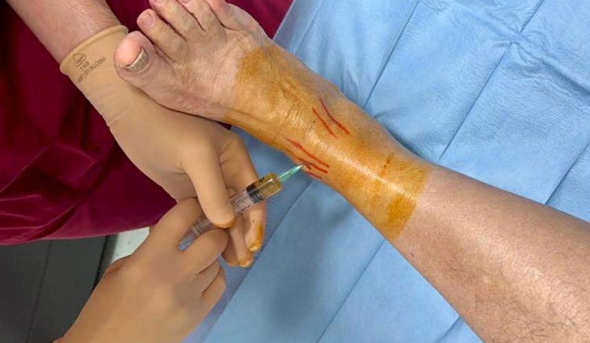 Cellule staminali: non limitiamoci al ginocchio!