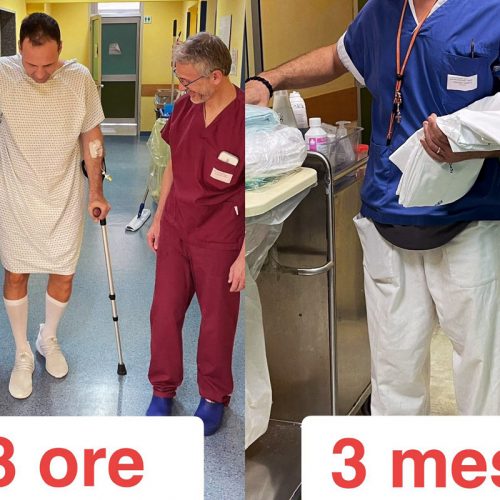 protesi anca accesso anteriore
