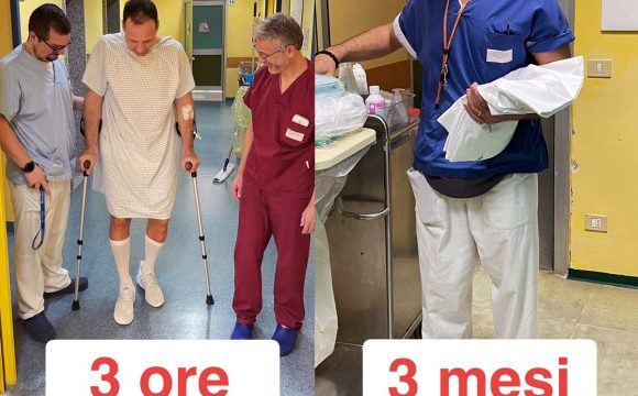 protesi anca accesso anteriore protesi anca accesso anteriore